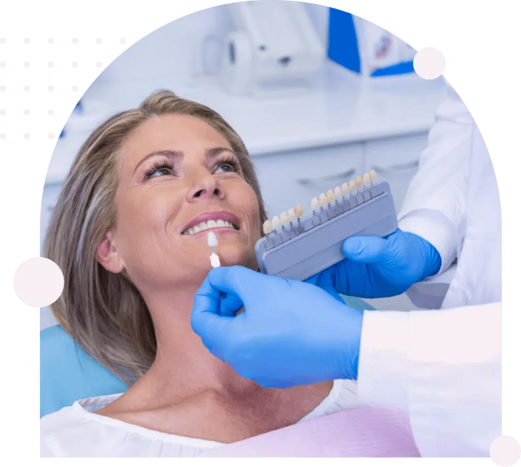 Dental shade matching for smiling female patient